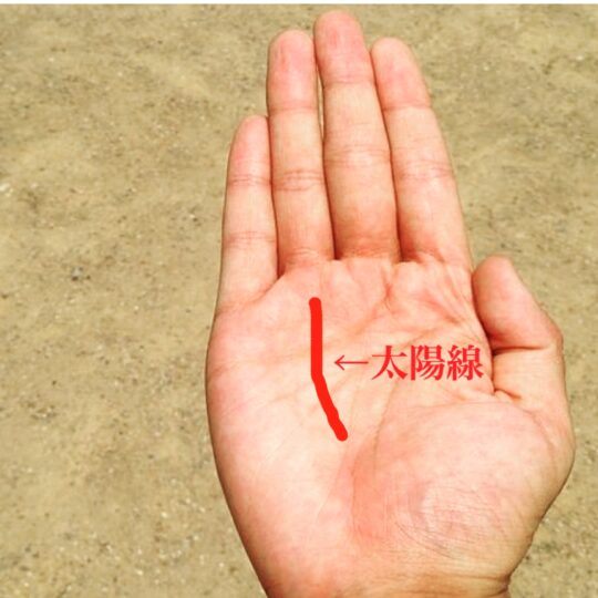 太陽線