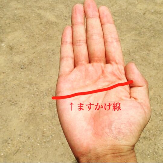 ますかけ線